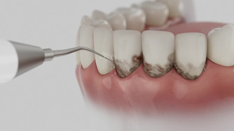 Reliable Dental Implants contractor in Ingleside, TX by Smile Center Dentistry
